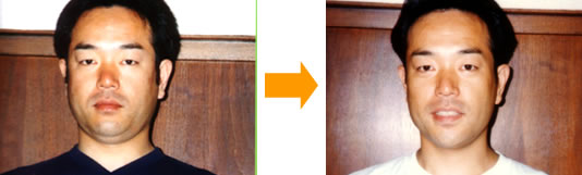 ���ڃ_�C�G�b�g������